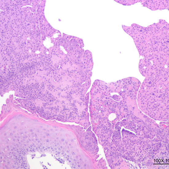 Preparation of collagen peptide nanoemulsions and liposomes from sturgeon skin and their effects on wound healing and diabetes in mice