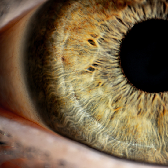 Homocysteine facilitates angiogenetic networks in choroid and retina