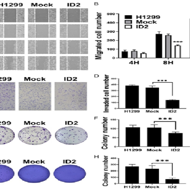 Effects of methylation and transcription factor YY1 on ID2 expression in non–small cell lung carcinoma cells.