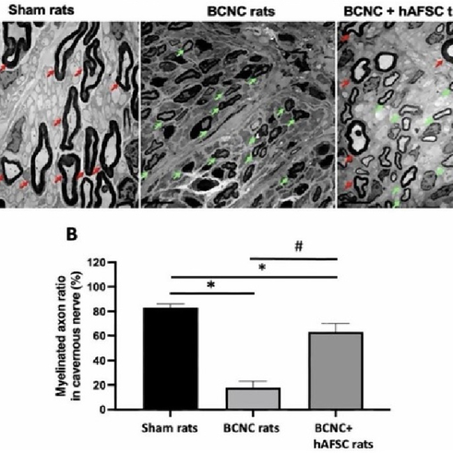 Harnessing the regenerative effects of human amniotic stem cells (hAFSCs) on restoring erectile function in a bilateral cavernous nerve crush (BCNC) injury rat model