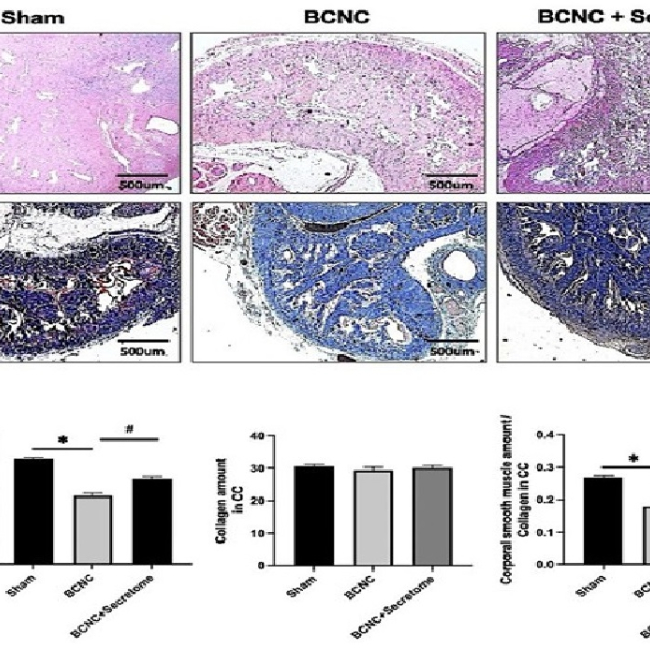 Preclinical investigation of cavernous nerve injury-induced erectile dysfunction treated with HAFSC-derived secretome