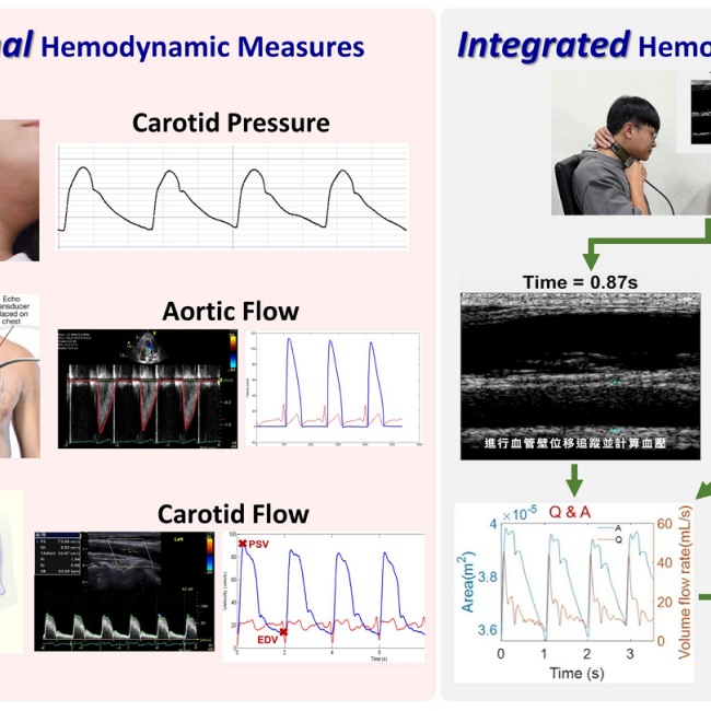 Next hemodynamic monitoring for assessing vascular aging- taking energy into consideration
