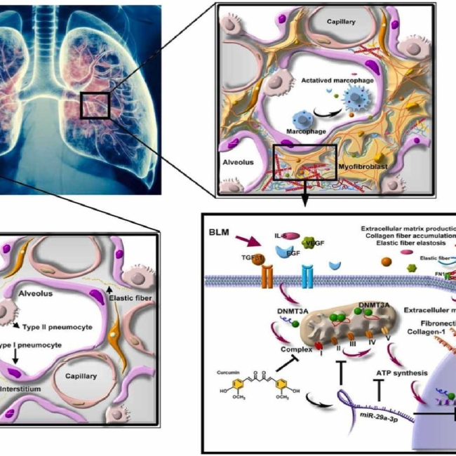 Curcumin regulates pulmonary extracellular matrix remodeling and mitochondrial function to attenuate pulmonary fibrosis by regulating the miR-29a-3p/DNMT3A axis