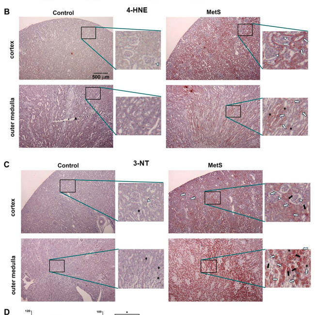 Transcriptomic redox dysregulation in a rat model of metabolic syndrome-associated kidney in-jury